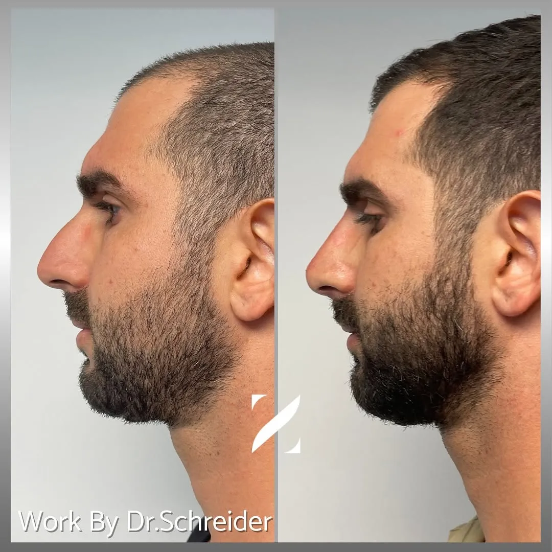 470149170_18382240561102878_2803839938478112099_n