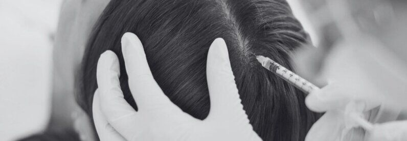 טיפול ננופט לדילול והתקרחות שיער זד מדיקל קלאב