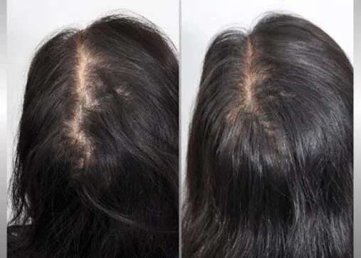 Regenera Activa שיער