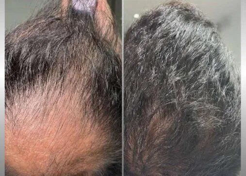 Regenera Activa שיער