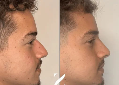 טיפולי אסתטיקה לגברים