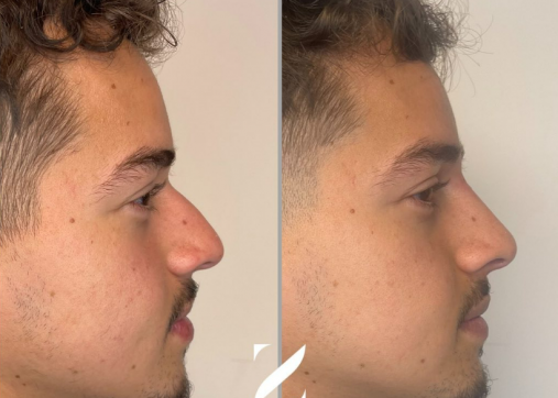 Aesthetic treatments for men